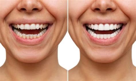 Achieve a Beautiful Smile with the Help of Smild Magic Dental in McKinney